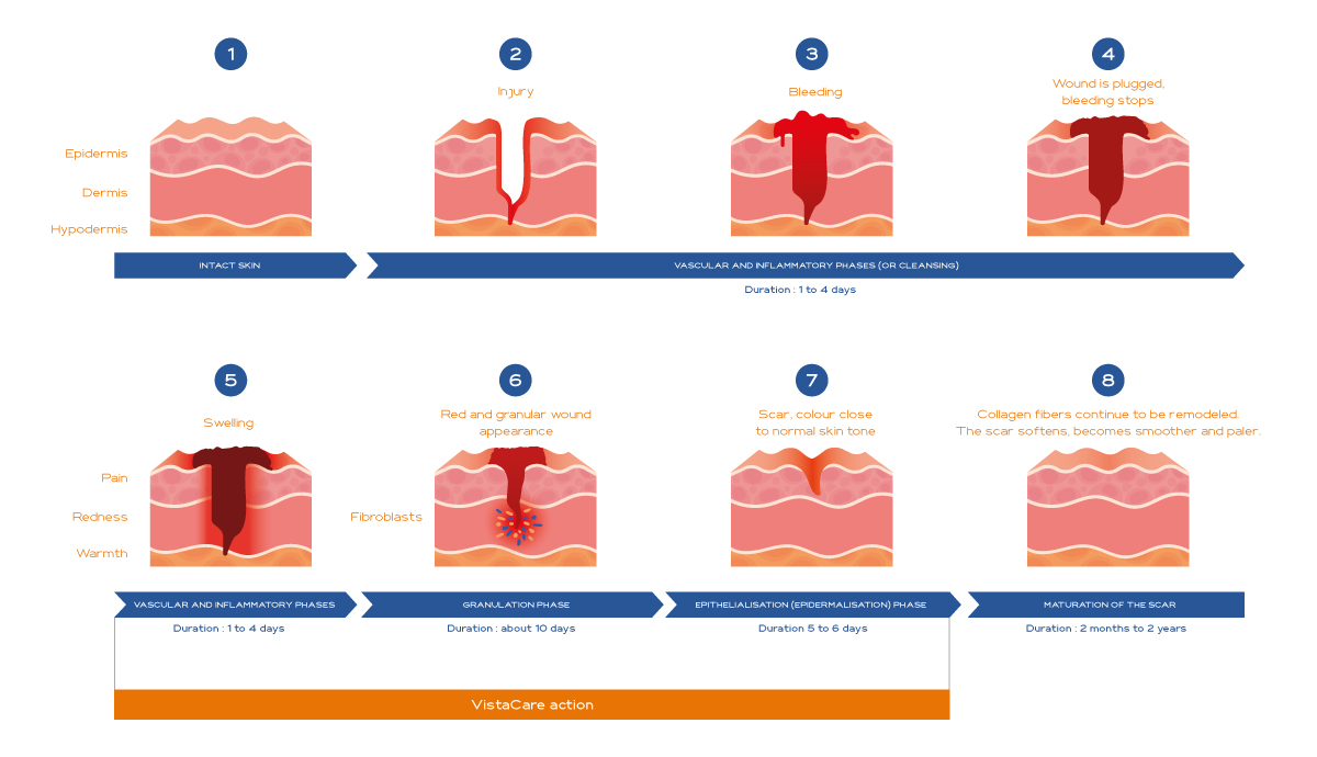 https://www.vistacare-medical.com/wp-content/uploads/2022/08/Schema-VistaCare_EN-1.jpg
